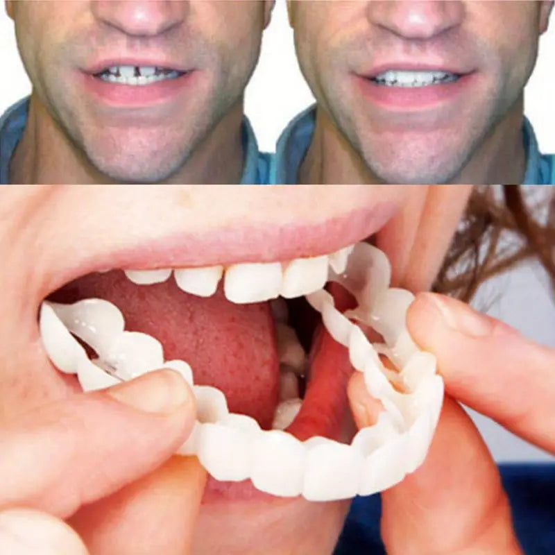 2 Pairs Snap-On Teeth Covers – Natural Look, Instant Smile Upgrade