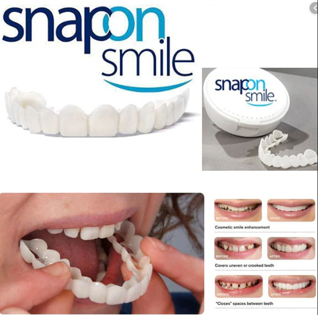 Snap on smile