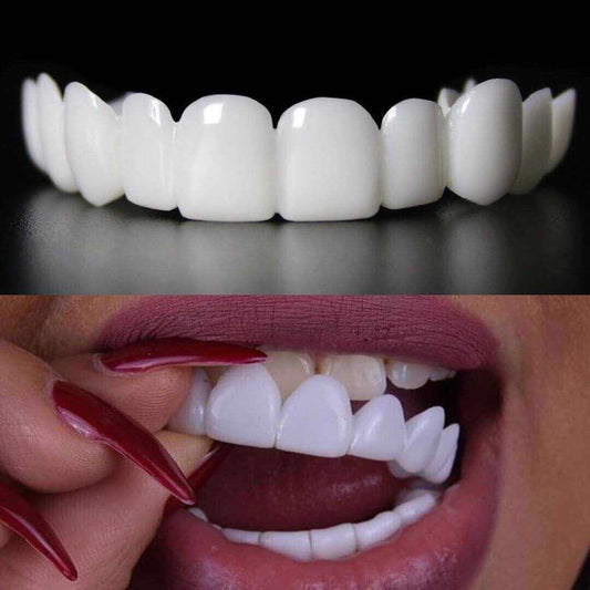 Snap on smile